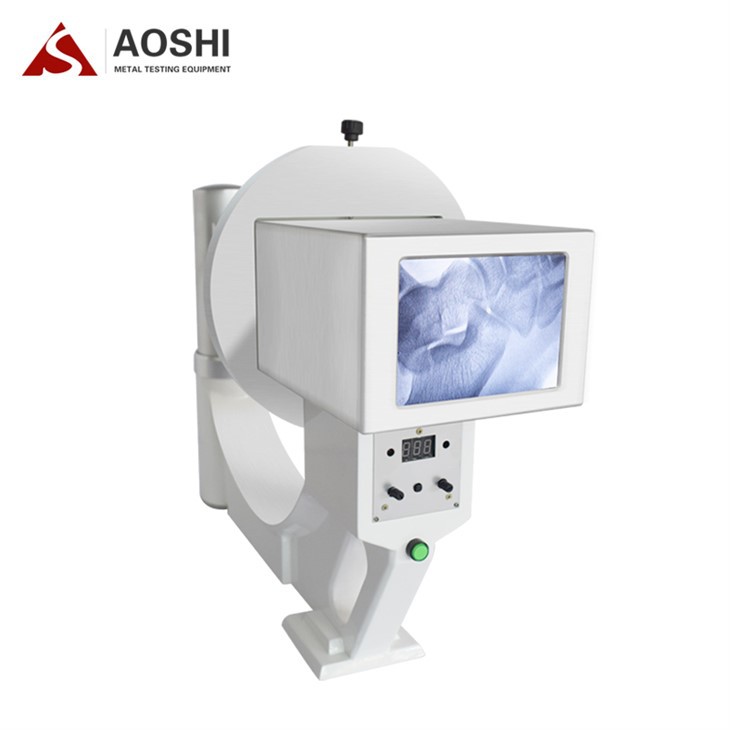 Рендген екстремитета